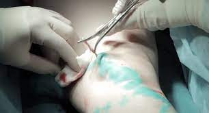 جراح اوعية دموية